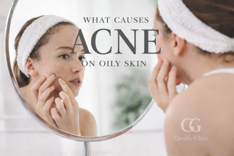 woman examining breakouts to understand what causes acne on oily skin