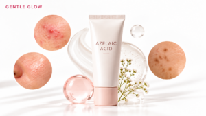 Azelaic acid for oily and acne-prone skin with close-ups of acne, oily pores, and post-acne dark spots