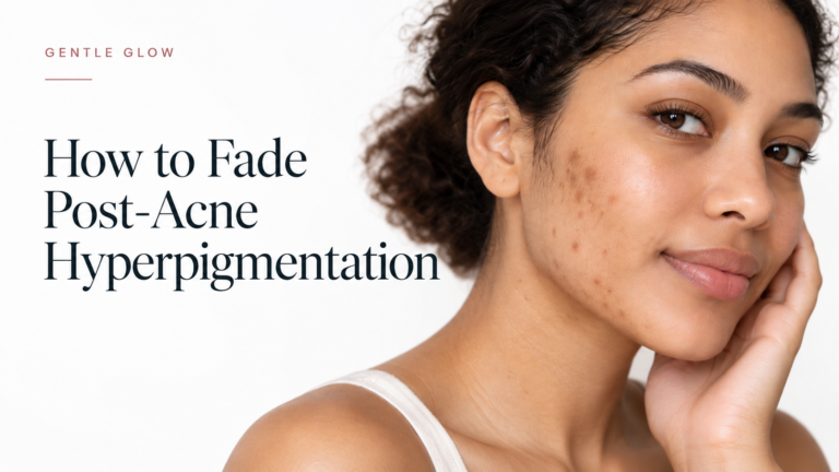Woman with post-acne hyperpigmentation marks on her cheek and jawline for Gentle Glow’s guide to fading PIH.